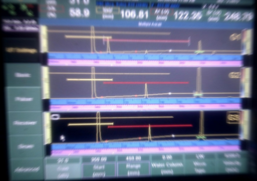 Implus Echo Verfahren